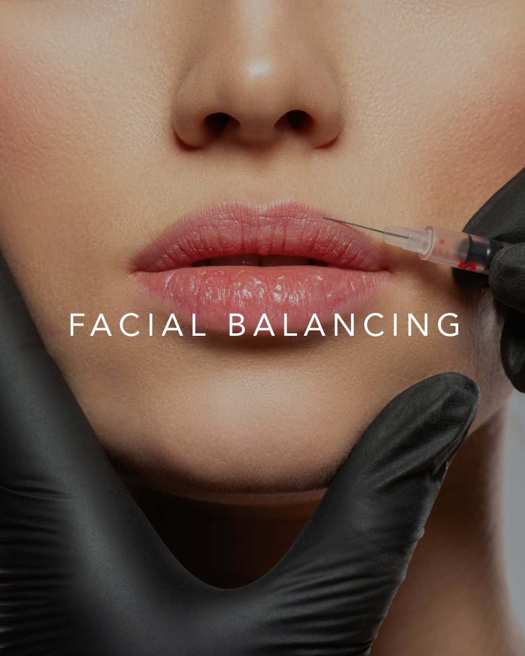 FACIAL BALANCING - Buy 3 Syringes or Vials get Lips Free