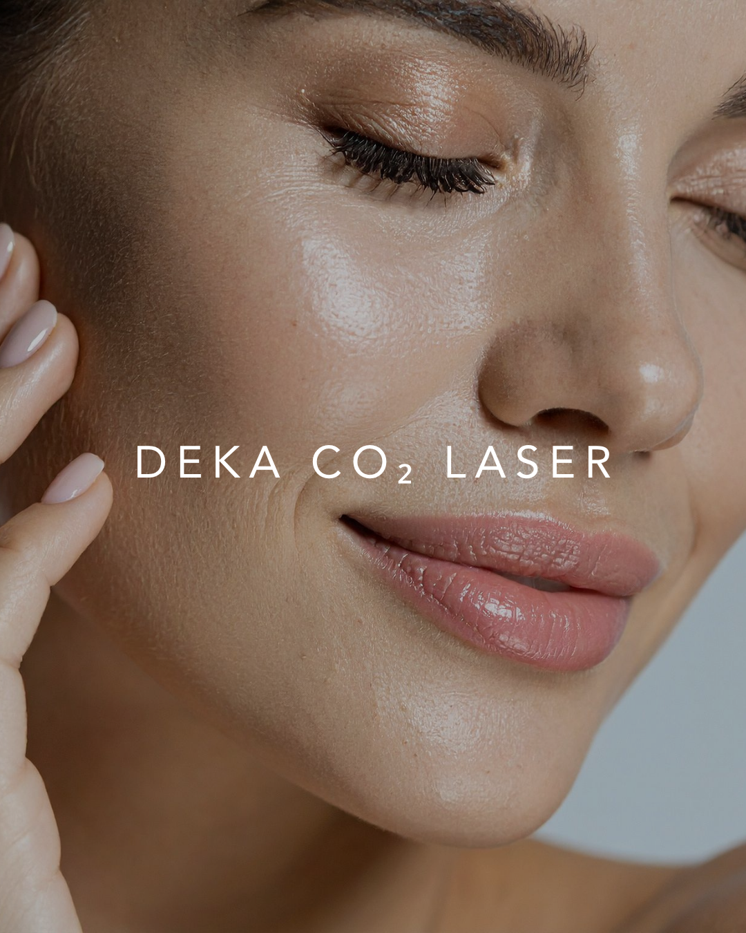 CO2 Deka Laser $2000