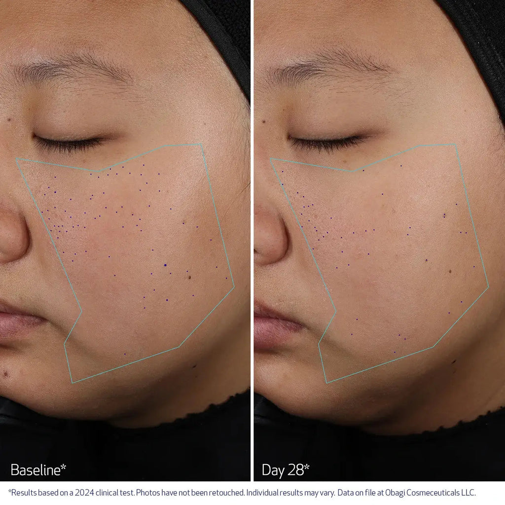Obagi Pore Therapy Exfoliating BHA Toner