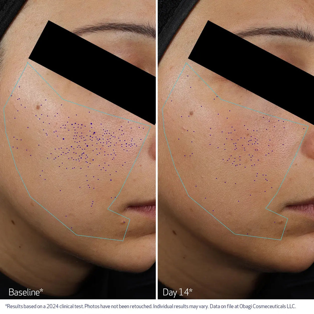 Obagi Pore Therapy Exfoliating BHA Toner